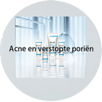 Acne en verstopte poriën Uden
