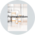 Pigmentvlekken Uden