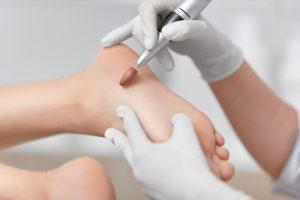 Medische pedicure Uden