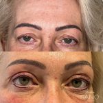 permanente make-up eyeliner Uden
