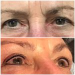 Permanente make-up eyeliner Uden