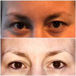 Permanente make-up eyeliner Uden