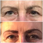 Permanente make-up 3D hairstrokes en hairstrokes Uden