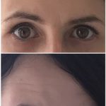 Permanente make-up eyeliner Uden